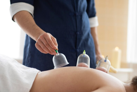 Hijama